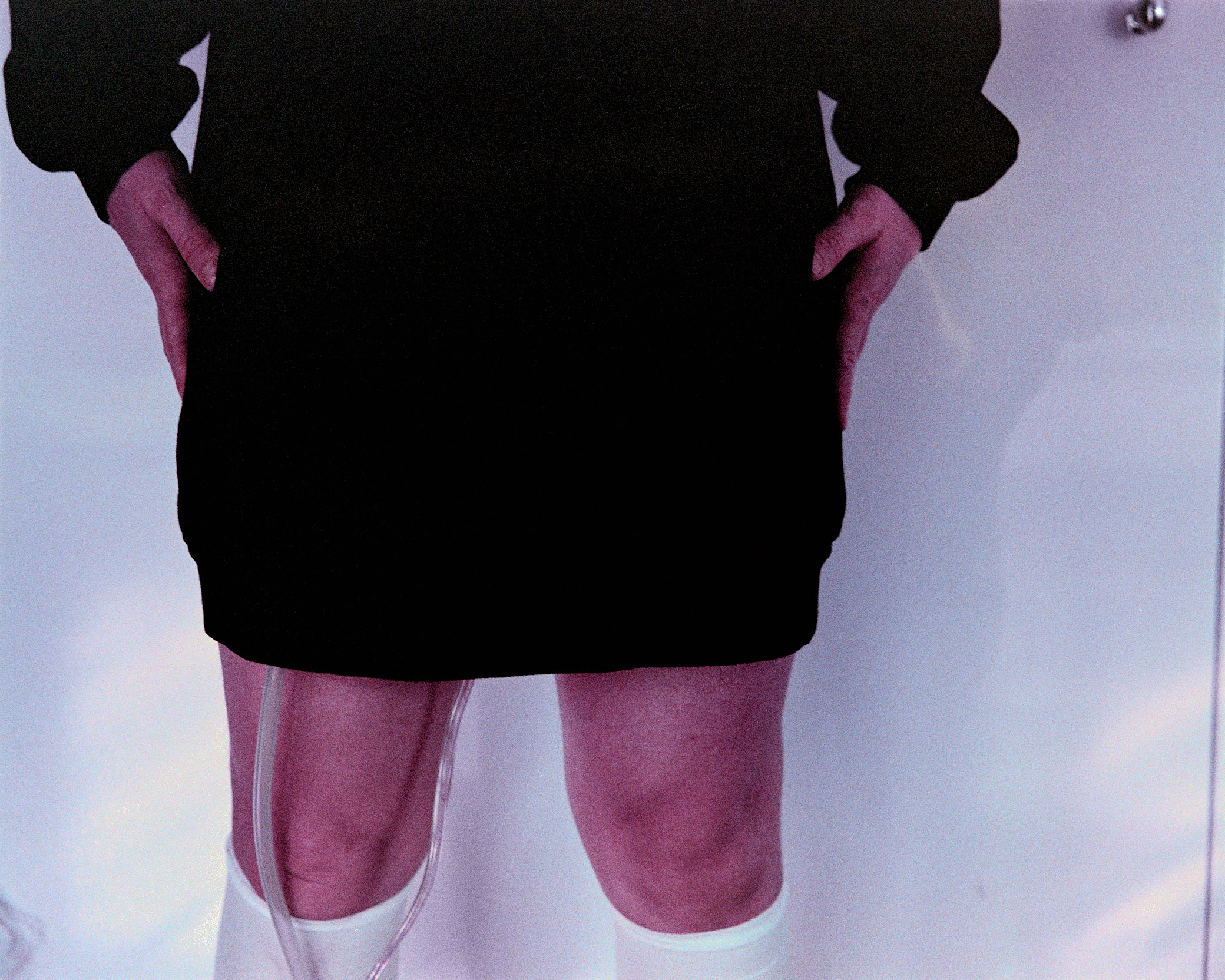 image of the artist shortly after gender affirming
care